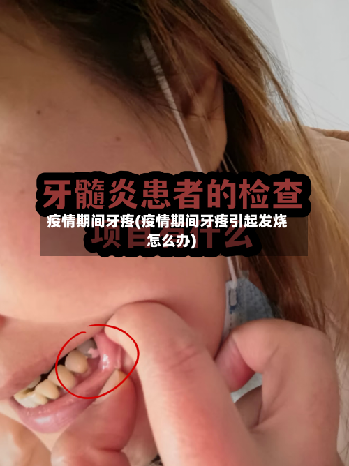 疫情期间牙疼(疫情期间牙疼引起发烧怎么办)